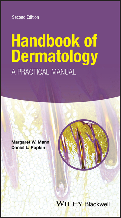 Handbook of Dermatology