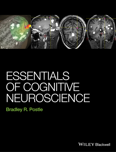 Essentials of Cognitive Neuroscience