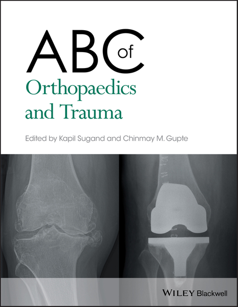 ABC of Orthopaedics and Trauma