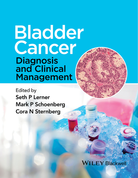 Bladder Cancer