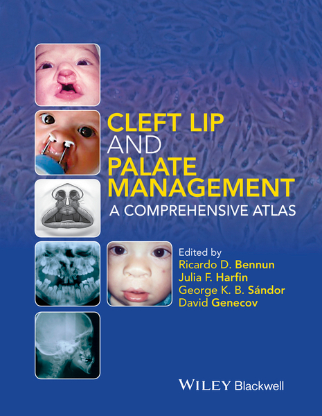 Cleft Lip and Palate Management