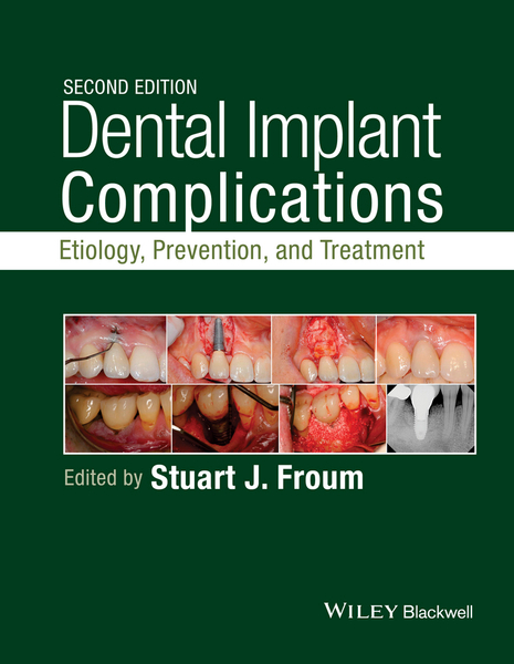 Dental Implant Complications