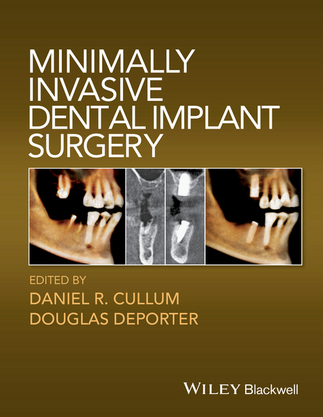 Minimally Invasive Dental Implant Surgery