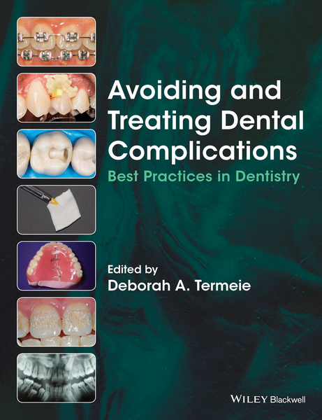 Avoiding and Treating Dental Complications