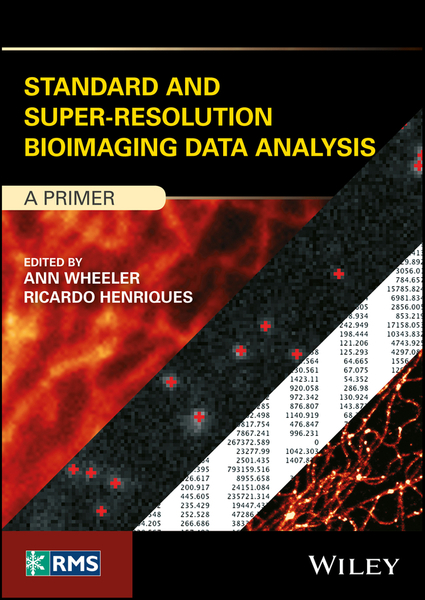 Standard and Super-Resolution Bioimaging Data Analysis