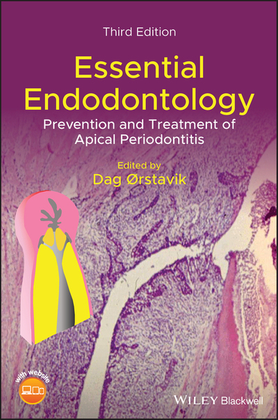 Essential Endodontology