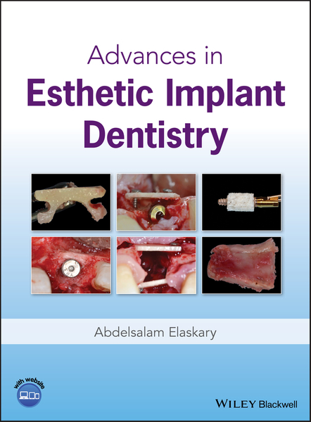 Advances in Esthetic Implant Dentistry