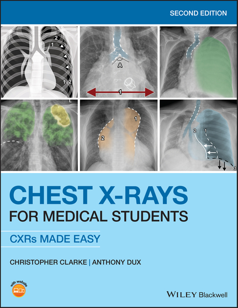 Chest X-Rays for Medical Students