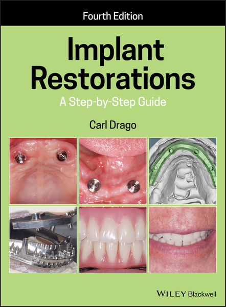 Implant Restorations