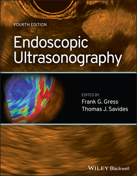 Endoscopic Ultrasonography