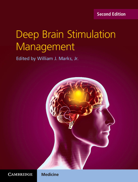 Deep Brain Stimulation Management