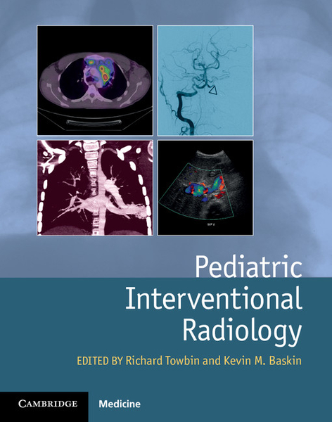 Pediatric Interventional Radiology