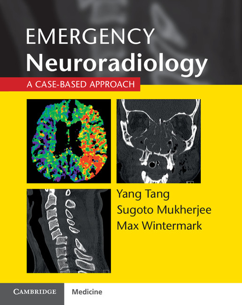 Emergency Neuroradiology