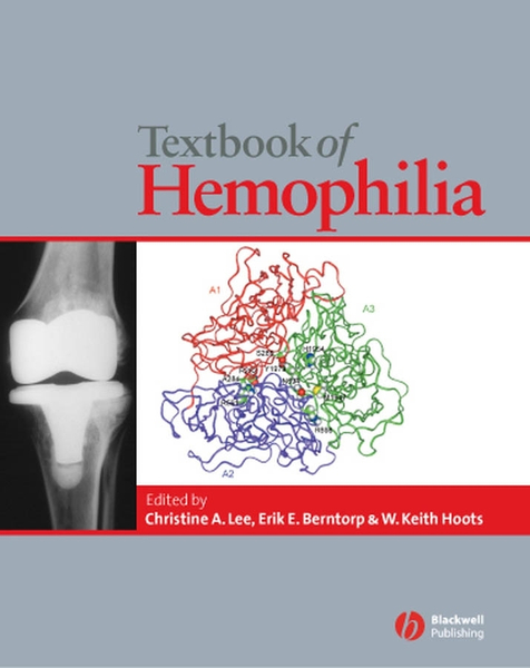 Textbook of Hemophilia