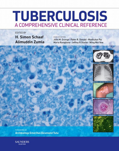 Tuberculosis E-Book