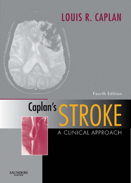 Caplan's Stroke E-Book