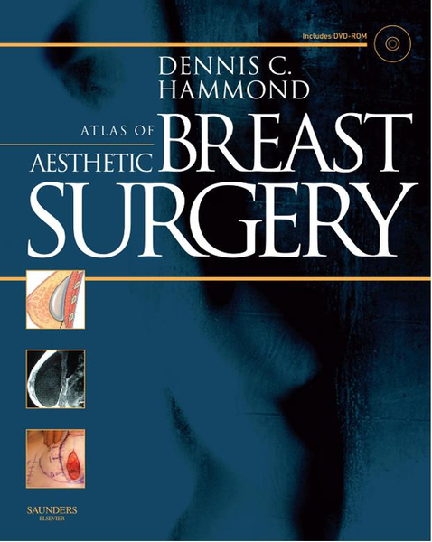 Atlas of Aesthetic Breast Surgery