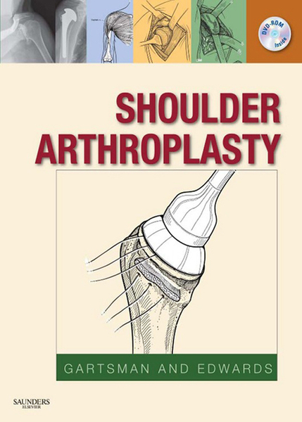 Shoulder Arthroplasty E-Book