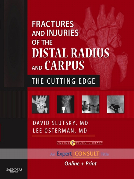 Fractures and Injuries of the Distal Radius and Carpus E-Book