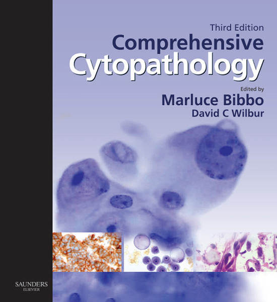 Comprehensive Cytopathology E-Book