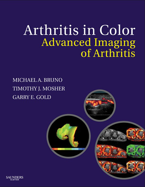 Arthritis in Color E-Book