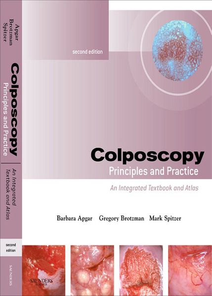 Colposcopy E-Book