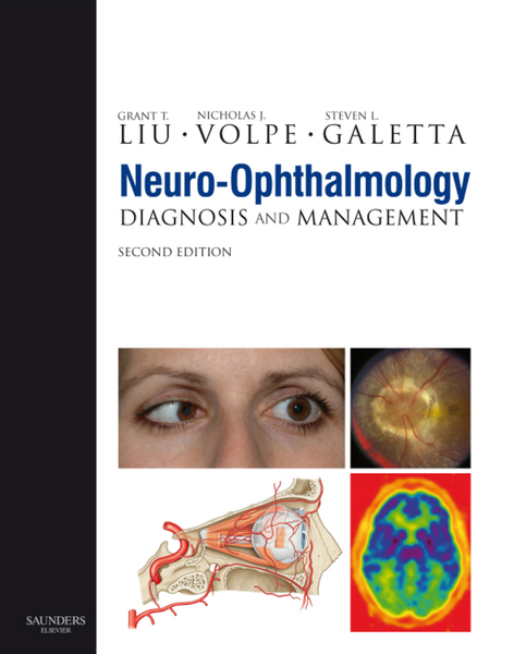 Neuro-Ophthalmology E-Book