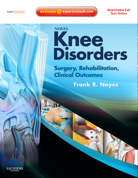 Noyes' Knee Disorders: Surgery, Rehabilitation, Clinical Outcomes E-Book