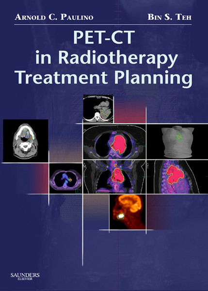 PET-CT in Radiotherapy Treatment Planning E-Book