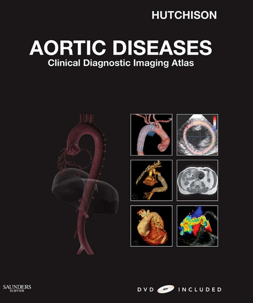 Aortic Diseases E-Book