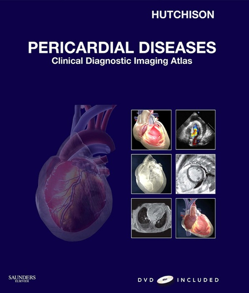 Pericardial Diseases E-Book