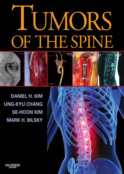 Tumors of the Spine E-Book