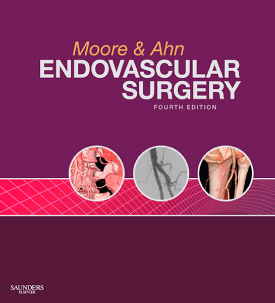 Endovascular Surgery E-Book