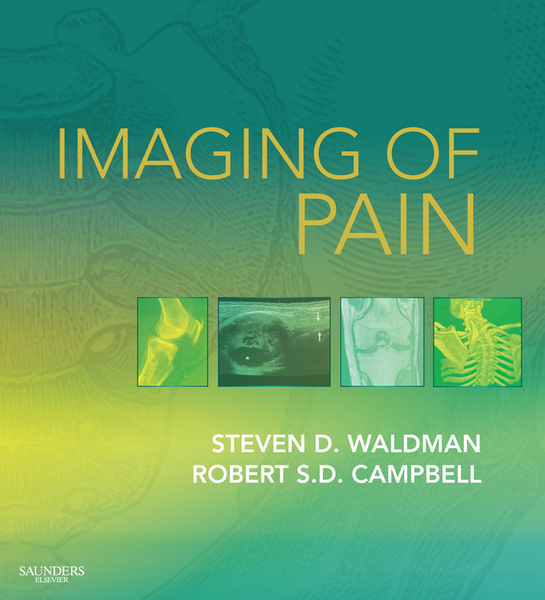 Imaging of Pain E-Book