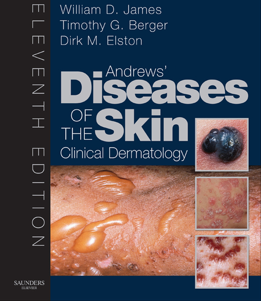 Andrew's Diseases of the Skin E-Book