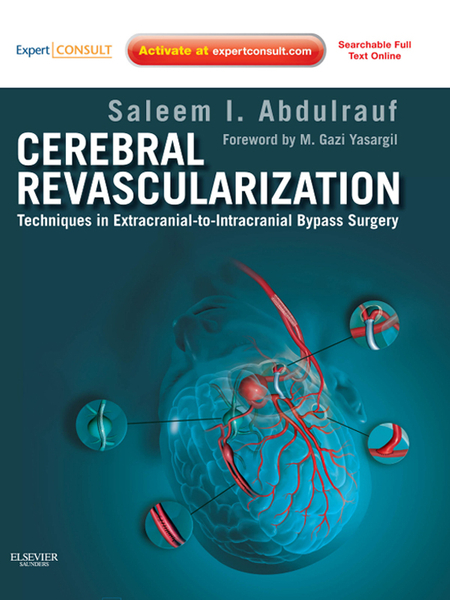 Cerebral Revascularization - E-Book