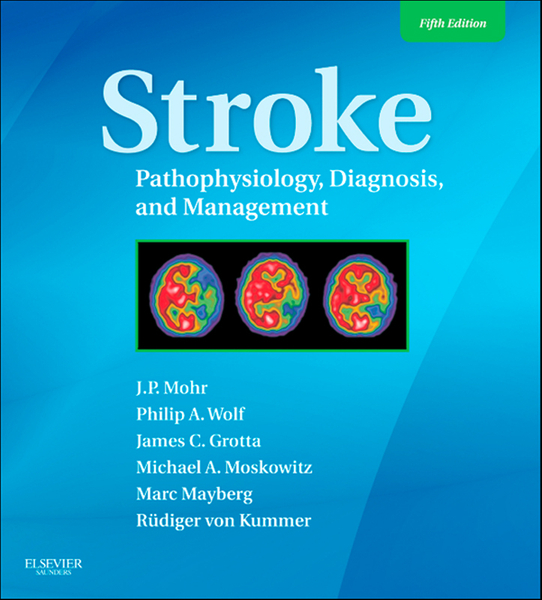 Stroke E-Book