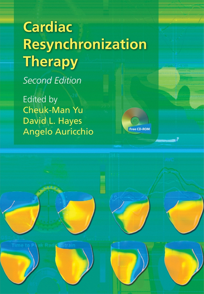 Cardiac Resynchronization Therapy