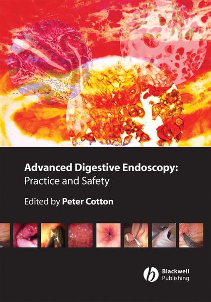 Advanced Digestive Endoscopy