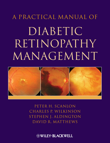 A Practical Manual of Diabetic Retinopathy Management