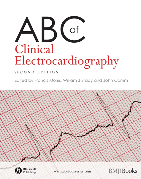 ABC of Clinical Electrocardiography