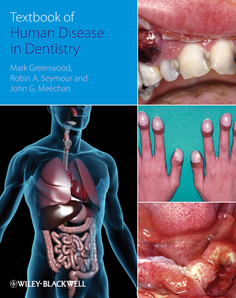 Textbook of Human Disease in Dentistry