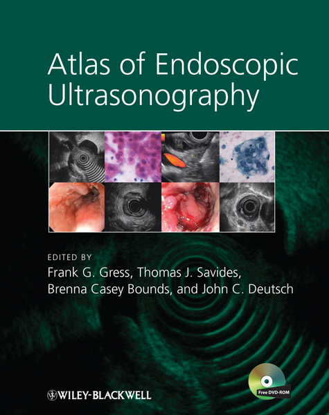 Atlas of Endoscopic Ultrasonography