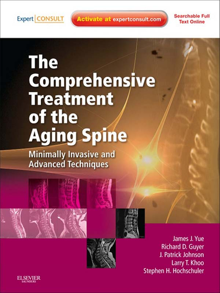 The Comprehensive Treatment of the Aging Spine E-Book