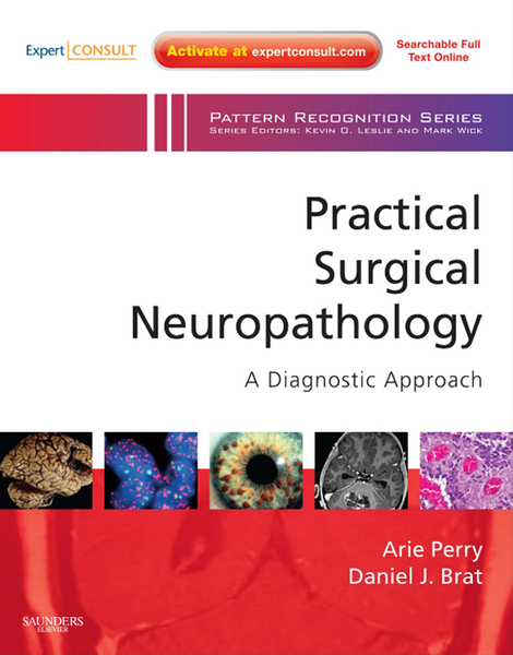 Practical Surgical Neuropathology: A Diagnostic Approach E-Book