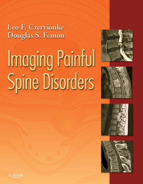 Imaging Painful Spine Disorders E-Book