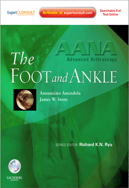 AANA Advanced Arthroscopy: The Foot and Ankle E-Book