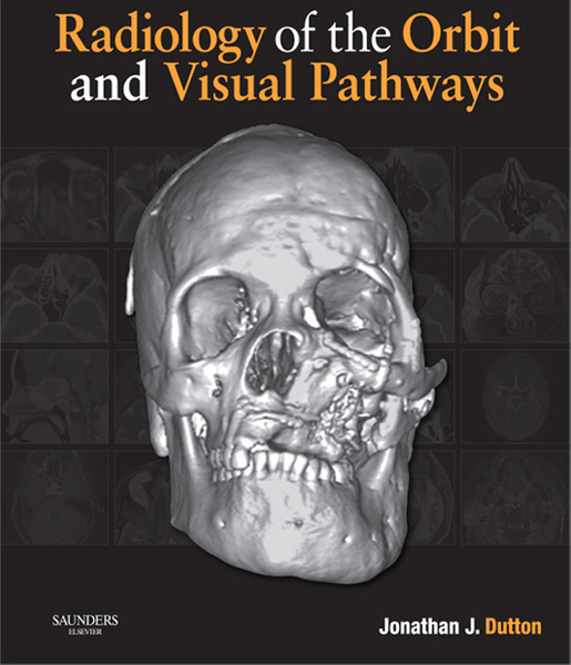 Radiology of the Orbit and Visual Pathways E-Book