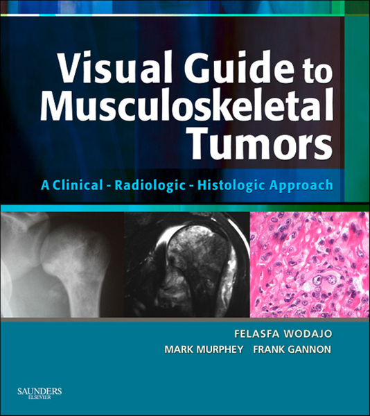 Visual Guide to Musculoskeletal Tumors: A Clinical - Radiologic - Histologic Approach E-BOOK