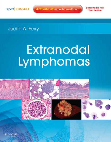 Extranodal Lymphomas